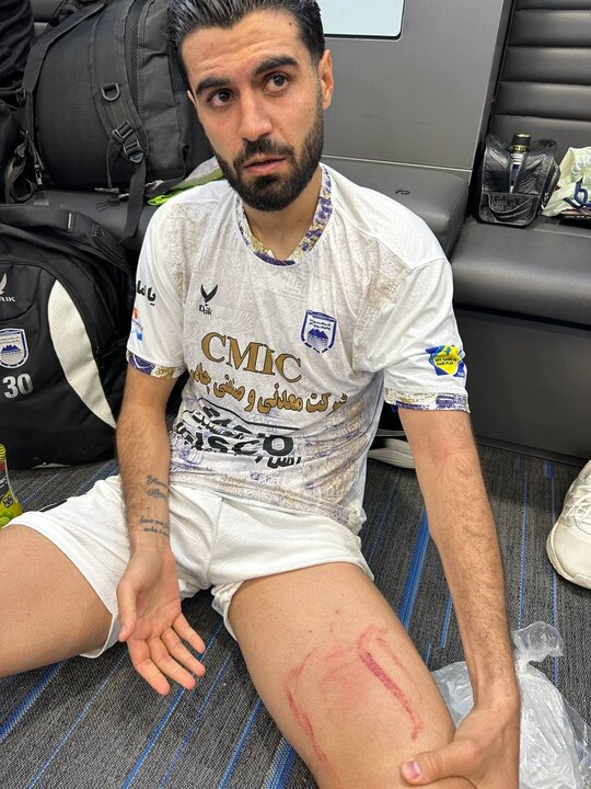 اعتراض چادرملو به داور بازی با استقلال و ندیدن صحنه خون‌آلود  + عکس